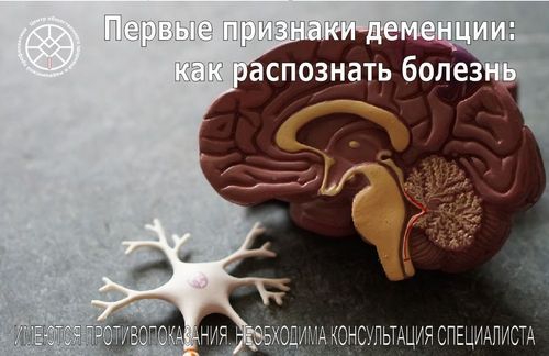 Первые признаки деменции: как распознать начало болезни